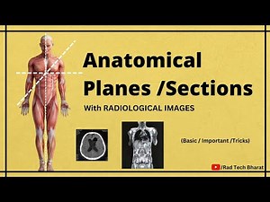 Anatomical Planes /Sections and its Importance in Radiology Department