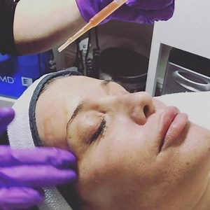 2.2K views · 14 reactions | What is a Vampire Facial? The Vampire...