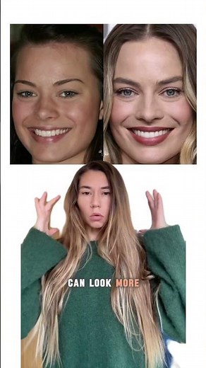 How Veneers Can Change Your Face Shape | Bite, Midface & Structural Effects Explained