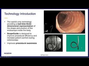 Improving Procedural Awareness Utilizing ScopeGuide