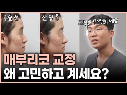 Are you still thinking about getting your beak nose corrected?