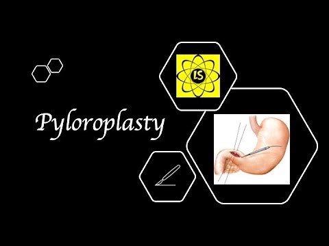 Pyloroplasty