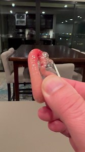 Specimen jar. | Rick Lax