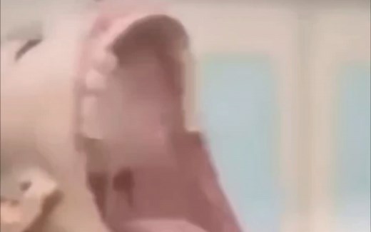 spitter突变罕见录像