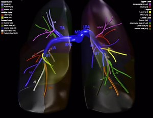 CT Pulmonary Angiography