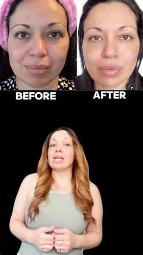Daniele Lima Method | Gua Sha Before & After #faceexercises #guasha #faceyoga #guashafacial