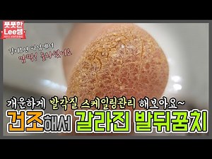 건조해서 갈라진 발뒤꿈치~ 개운하게 갈아내드릴게요~ removal callus / foot scaling - Fresh Foot 성수점 / 남양주호평점