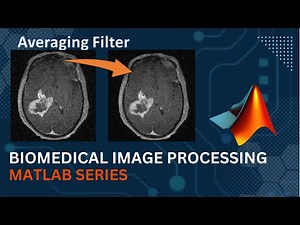 Averaging Filter || MATLAB Code Implementation || Medical Image Processing | Computer Vision