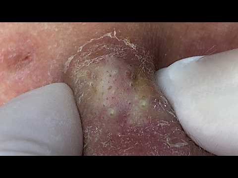 𝑺𝒐𝒐𝒕𝒉𝒊𝒏𝒈 𝑭𝒂𝒄𝒊𝒂𝒍 𝑻𝒓𝒆𝒂𝒕𝒎𝒆𝒏𝒕 𝑭𝒐𝒓 𝑺𝒕𝒓𝒆𝒔𝒔 𝑹𝒆𝒍𝒊𝒆𝒇 𝒂𝒕 𝑳𝒖𝒙𝒖𝒓𝒚 𝑺𝒑𝒂 𝑨𝒄𝒉𝒊𝒆𝒗𝒆 𝑰𝒏𝒏𝒆𝒓 𝑷𝒆𝒂𝒄𝒆 #50669