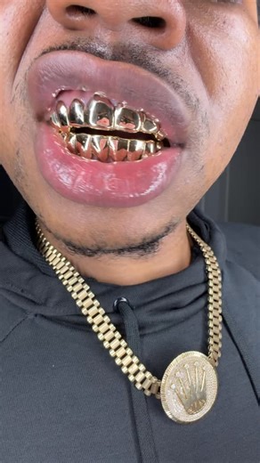 deontae foley on Instagram: "GRILLZ FROM @pristinegrillz 🥶"