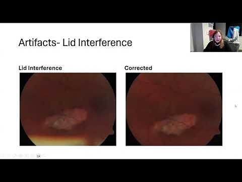 Lecture: The Fundamentals of Ophthalmic Fundus Photography