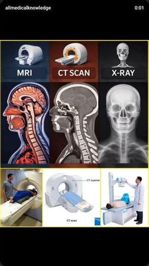radiology imaging techniques...#radiology #radio #mriscan
