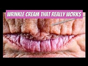 Wrinkle Cream That Really Works [TRUE REVIEW!]