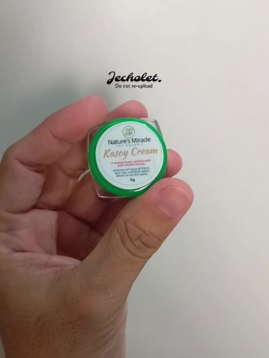 Goodbye Mole! Effortlessly Remove Moles with Kasoy Cream