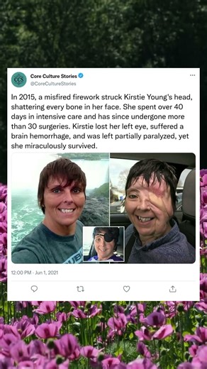 Firework Tragedy – The Survival of Kirstie Young #Shorts