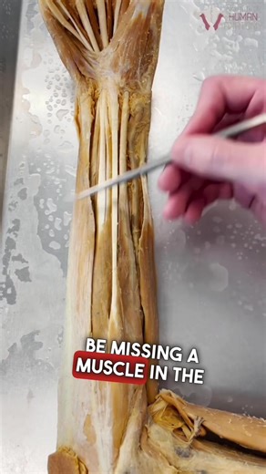 Discovering the Palmaris Longus Muscle in Your Wrist