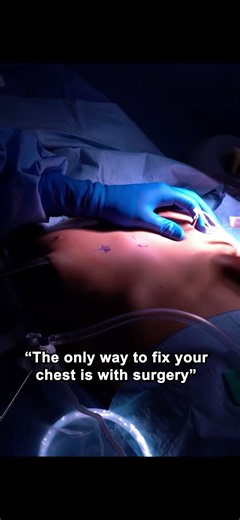 "The Only Way to Fix your Chest is with Surgery"