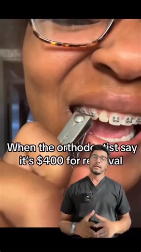 🧲 Don’t Remove Braces With Toenail Clippers! 🧲 It might look like a quick “hack” online — but removing your own braces at home is one of the most dangerous dental mistakes you can make. 🚫 Braces are bonded to your enamel with a special adhesive that’s meant to be removed only with orthodontic tools. Using toenail clippers, pliers, or wire cutters might seem easy, but here’s what really happens: 🦷 1️⃣ Enamel Damage: The adhesive is strong. When you pry off a bracket with force, you risk crack