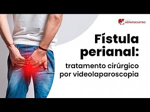 Fístula perianal: tratamento cirúrgico por videolaparoscopia | Clínica Hepatogastro
