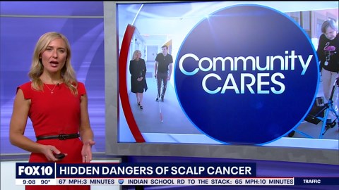 Hidden dangers of scalp cancer l Community Cares