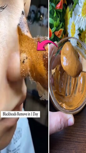 1.2M views · 6.5K reactions | How to get rid of blackheads instantly #skincare #beauty | Divine Beauty Tips | Facebook