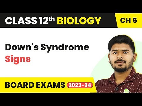 Class 12 Biology Ch 5 | Down's Syndrome (Signs) - Principles of Inheritance and Variation 2022-23