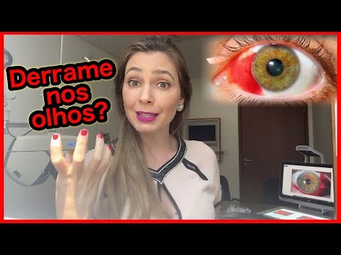 Eye hemorrhage: What to do?