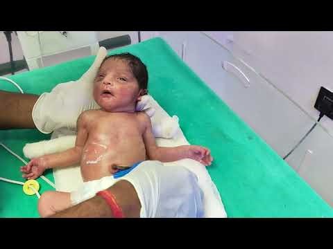 Newborn Baby Hungry Crying & Bottle Feeding | Soothing Milk Time 🍼