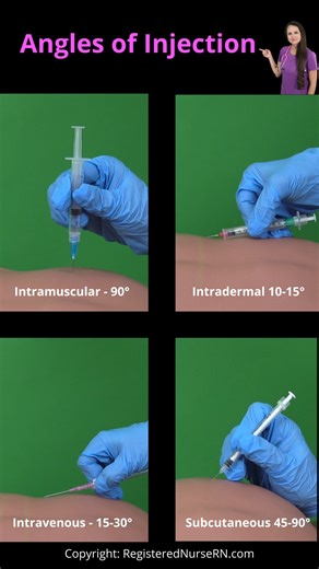 Angles of Injection Nursing: Subcutaneous, Intramuscular, Intradermal, and Intravenous When injecting a medication or starting an IV, you'll want to pay attention to the angle of Injection to ensure the solution is delivered to the appropriate tissue. IM is delivered into the muscle at a 90 degree angle. Subq can be 90 or 45. Intradermal is 10-15 degrees, and Intravenous is 15-30 degrees. #studygram #nursing #nurse #nursingschool #injection #rn #nursingstudent #education | Registerednursern.com
