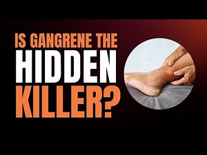 Gangrene Warning: Causes, Symptoms, and Facts You Must Know!