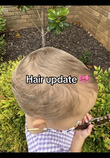 One month of hair growth! It’s so soft and fluffy. We will have to see what it grows back like, will it be curly again? #cancer #childhoodcancer #hair #leukemia #mumsoftiktok