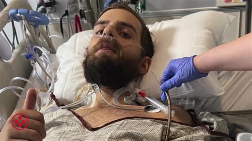 VIDEO: Celebrating Our ECMO Team & Critical Care Specialists During Critical Care Awareness Month, we recognize the amazing ECMO team and critical care specialists at Medical City Fort Worth who provide life-saving support when patients need it most. ECMO (extracorporeal membrane oxygenation) serves as a temporary heart-lung support system, giving critically ill patients time to heal. Thanks to their expertise and dedication, patients like Zach Furlow, featured in the video below, have a second 