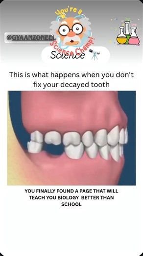 Human Teeth...🦷#human#teeth #humanphysiology #scientificjourney #science #sciencefacts #beyondspace