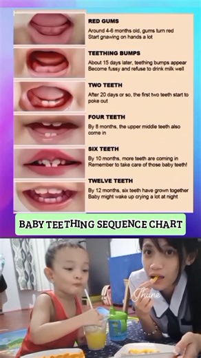 Baby Teething Sequence Chart.. #guidelines #awareness #parenting #teethingstage Acrixa Balino | Momshie Jhane Alcos