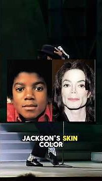 Why did Michael Jackson’s skin color change?