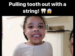 Pulling tooth out with a string
