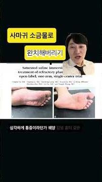 ‼️Introducing a brilliant method to completely cure warts with saltwater‼️