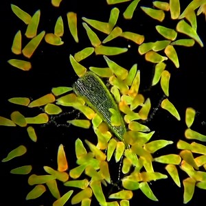 These are single-celled organisms called stentors, and because of their shape, they are also known as trumpet animalcules. This species is called stentor amethystinus and they can reach a size of a couple of millimeters — making them some of the largest known single-celled organisms in the world. #MicroscopicMonday 🧫🔬 by My Microscopic World | Science Channel