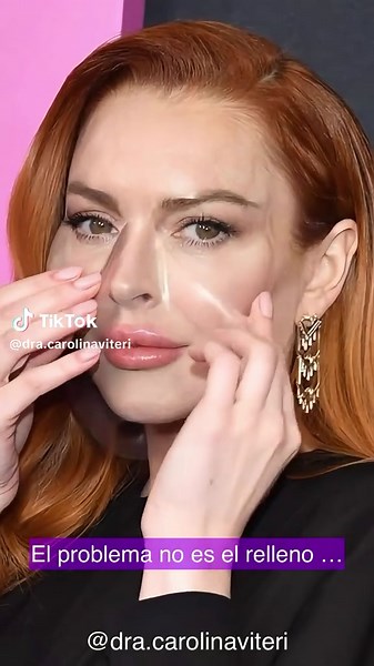 Armonización Facial: Menos es Más en Medicina Estética