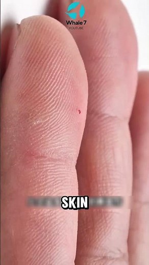 This Is Why Predators Fear Porcupines