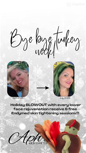 Bye Bye Turkey Neck! Book any lower-face rejuvenation treatment and receive six EndyMed skin-tightening sessions—on us. #kentucky #medspa #beauty #fyp #facialtreatment