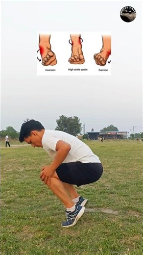 The Knock Knee 🤕? Solution 🤔