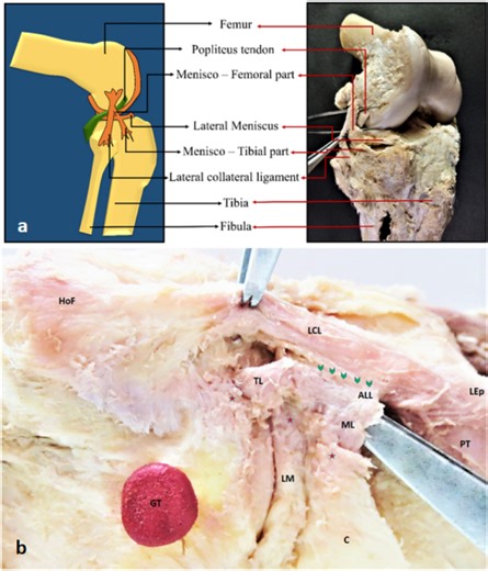 Sharing of proximal fibers by the anterolateral and lateral collateral ligaments in the human knee: a cadaveric study - Scientific Reports