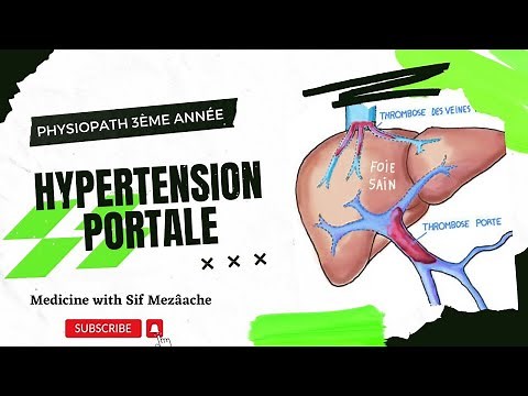 6/ Hypertension Portale | Physiopath 3éme MED