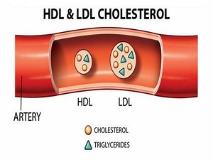 Chỉ số LDL cholesterol trong máu là gì?