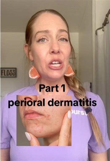 Is Your Toothpaste Causing Perioral Dermatitis?