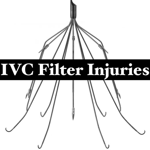 IVC Filter Injuries
