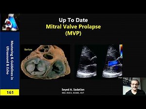Mitral Valve Prolapse (MVP)