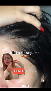 3.2M views · 41K reactions | El paso a paso de porqué tenés el cuero cabelludo graso, frecuencia de lavado y qué shampoo debés elegir y cuál evitar ☺️.Contame cuál estás utilizando?...#drapascali #skincare #haircare #rutinadecabello #rutinadecuidadidecabello #haircaretips | Dra. Daniela Pascali - Dermatología & Medicina Estética | Facebook