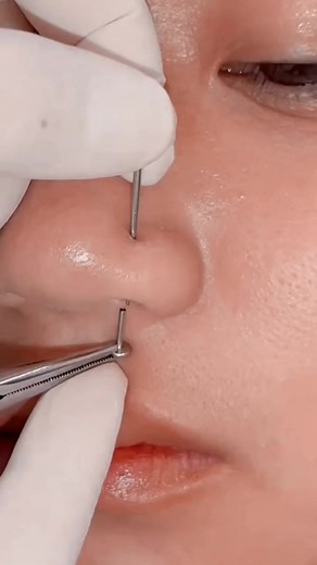 Join The Piercing World and get inspired by our piercing ideas!💉❤️ #piercing #piercingcheck #piercingideas #thepiercingworld #thepiercingclub #fyp #foryou #foryourpagereels | The Pimple World